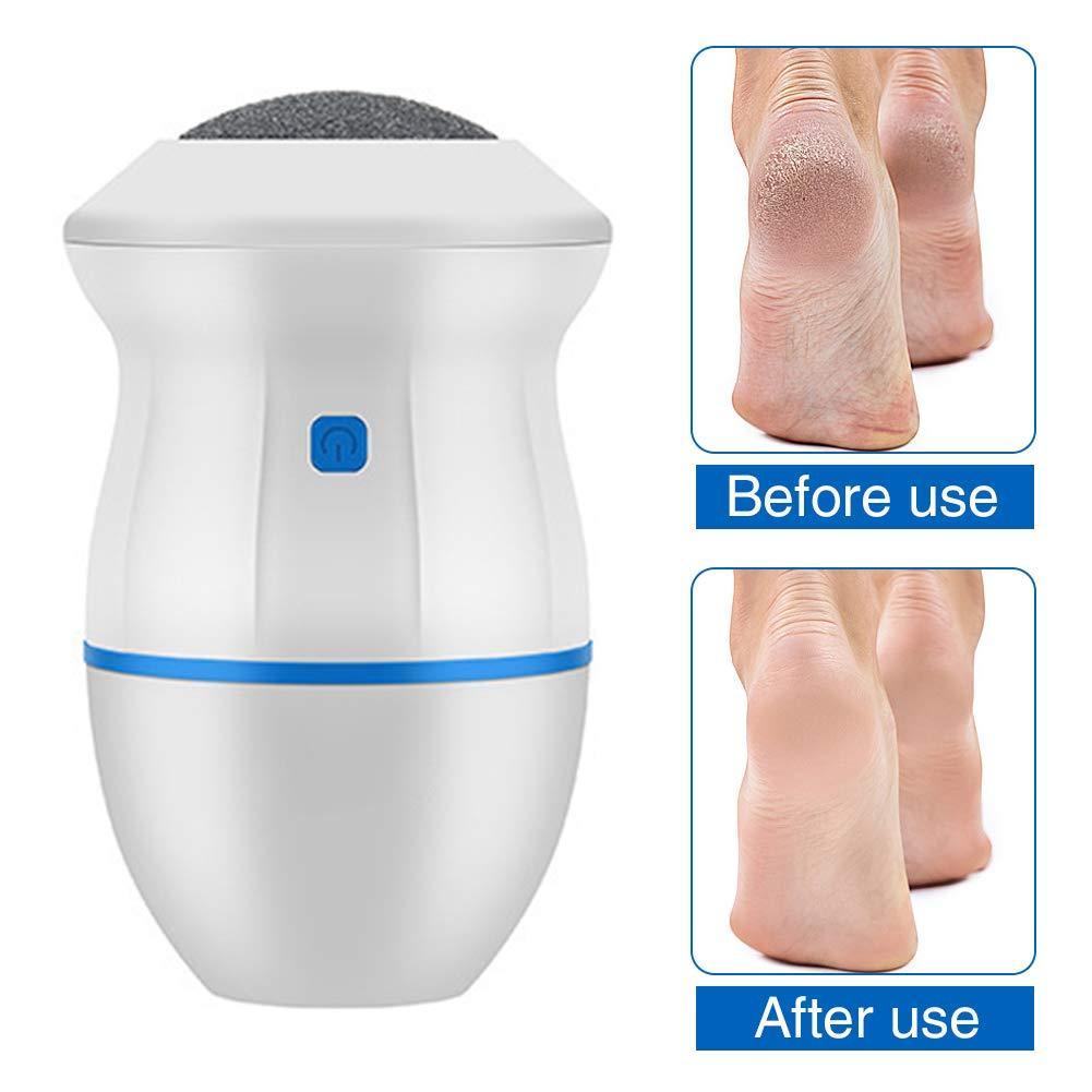 Electric Callus Remover with Built-In Vacuum & Foot Grinder Head – Professional Pedicure Tool for Soft, Smooth Feet – USB Rechargeable, Easy to Use, & Effective Foot Care