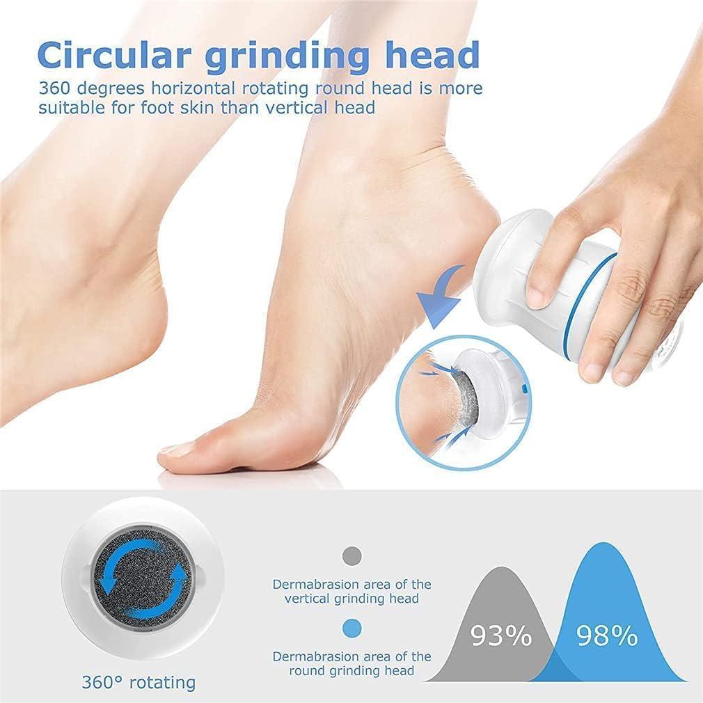 Electric Callus Remover with Built-In Vacuum & Foot Grinder Head – Professional Pedicure Tool for Soft, Smooth Feet – USB Rechargeable, Easy to Use, & Effective Foot Care