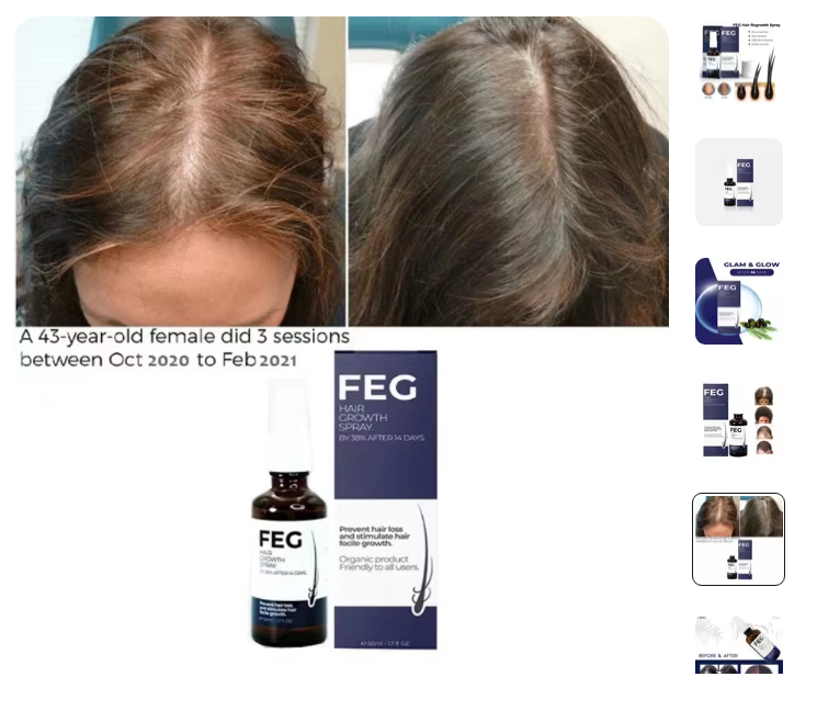 Hair Growth Spray for Thicker, Fuller Hair | Fast-Acting Hair Regrowth Formula | Boost Hair Growth for Men & Women in UAE